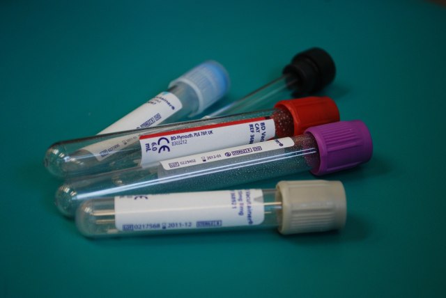 Drug & Alcohol Screening